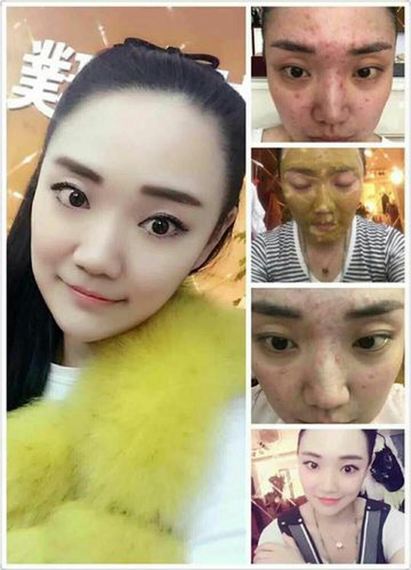 专业祛皱(逆时光奇迹：专业除皱美白，绽放青春焕彩)-第1张图片-情感驿站