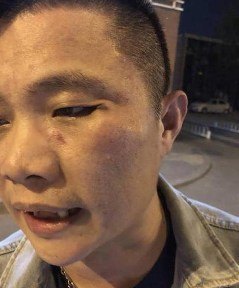 接 *** 被辱骂怎么办(被 *** 折磨得失声的娇柔受)-第1张图片-情感驿站 接 *** 被辱骂怎么办(被 *** 折磨得失声的娇柔受)-第1张图片-情感驿站