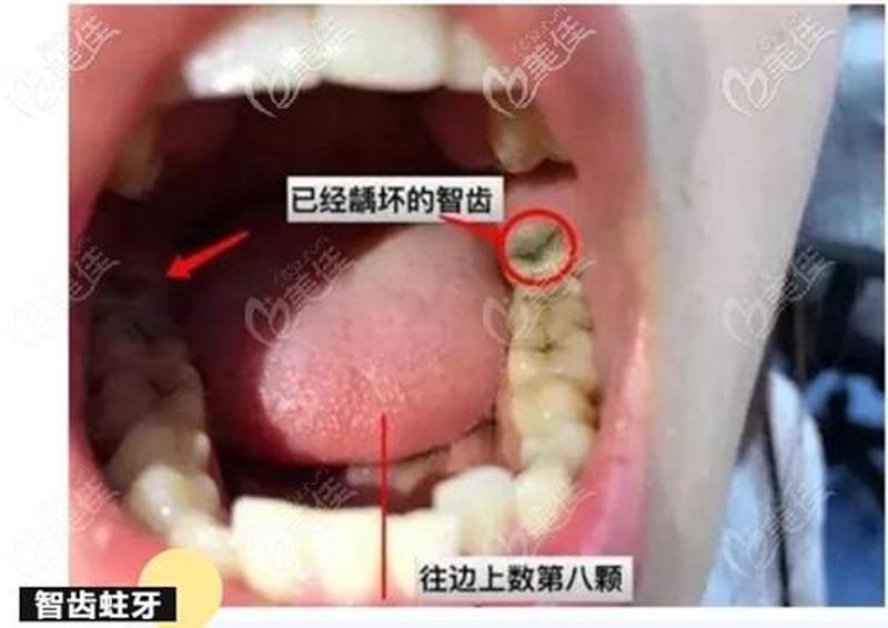 又大又粗又硬拔不出来_难以拔除的庞然巨物，卡住难解之困-第1张图片-情感驿站