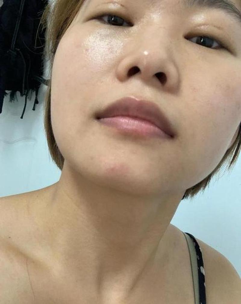 嘴唇越舔越干裂是因为什么—嘴唇越舔越干裂：唾液中的酶捣乱-第1张图片-情感驿站