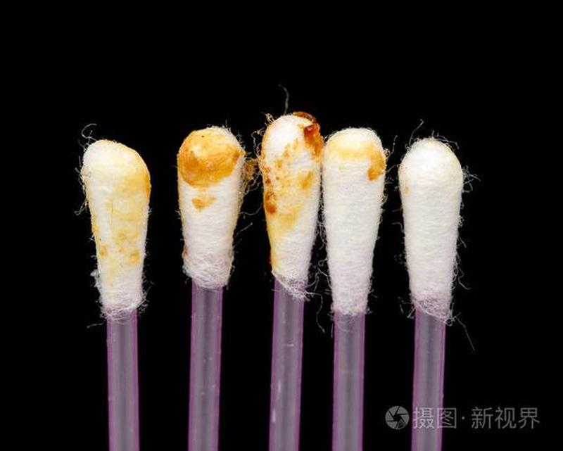棉签diy(一根棉签，解锁无限可能：从耳垢到艺术)-第1张图片-情感驿站