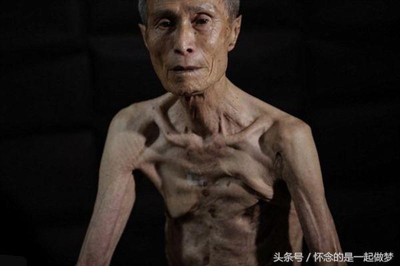 幸存者综合征和创伤后应激障碍(幸存者的寂寥与不配得感：揭开背后的真相)-第1张图片-情感驿站