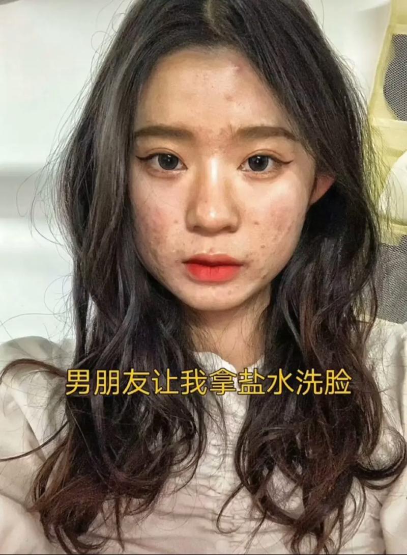 男朋友吃自己的痘痘的感觉—男友痘痘饕餮盛宴：探索自痘自嗨的禁果之旅-第1张图片-情感驿站