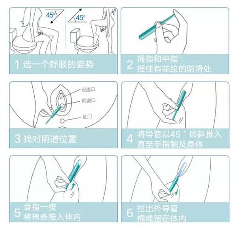 卫生棉条怎么用的 图解—卫生棉条使用指南：初学者必备小秘方-第1张图片-情感驿站
