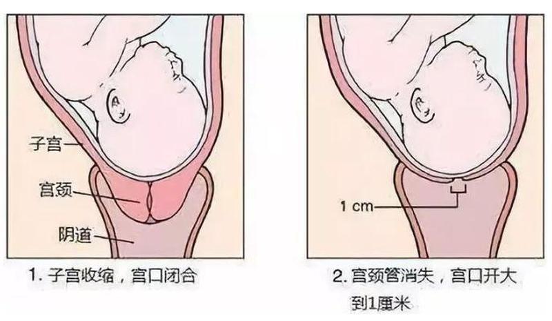 生孩子宫口在什么位置图片—剖宫产直击视角：见证胎儿的诞生-第1张图片-情感驿站