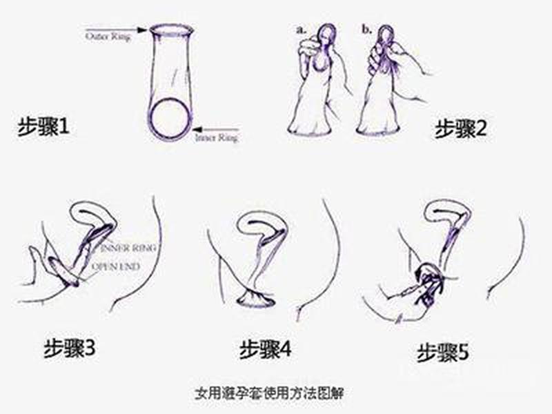 怎样使用避孕套—无痕呵护，女性主动避孕新体验-第1张图片-情感驿站