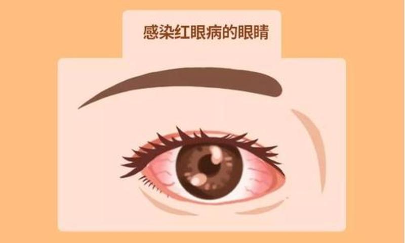 为什么爽的时候眼睛是往上的呢—眼上翻，妙不可言：揭秘爽时的生理反应-第1张图片-情感驿站