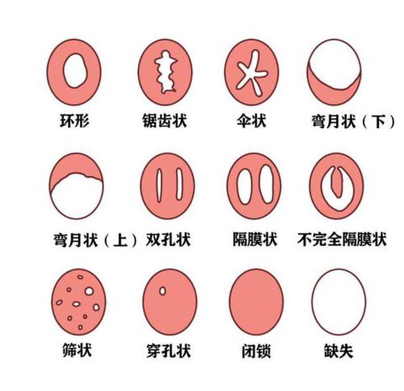 处nu膜是怎样才算破了—初次体验的男生也会痛吗？-第1张图片-情感驿站