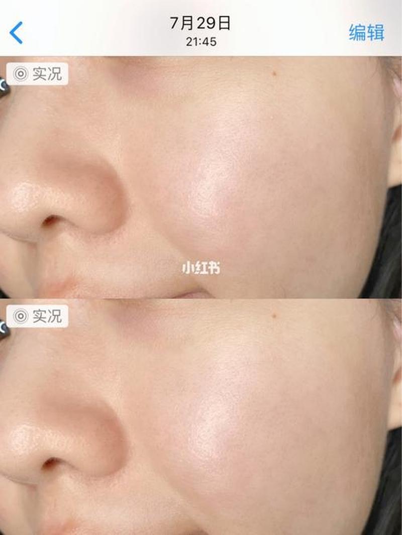 脸颊两侧疙瘩_脸颊疙瘩的困扰：找寻无暇肌肤的秘密-第1张图片-铖浩科技