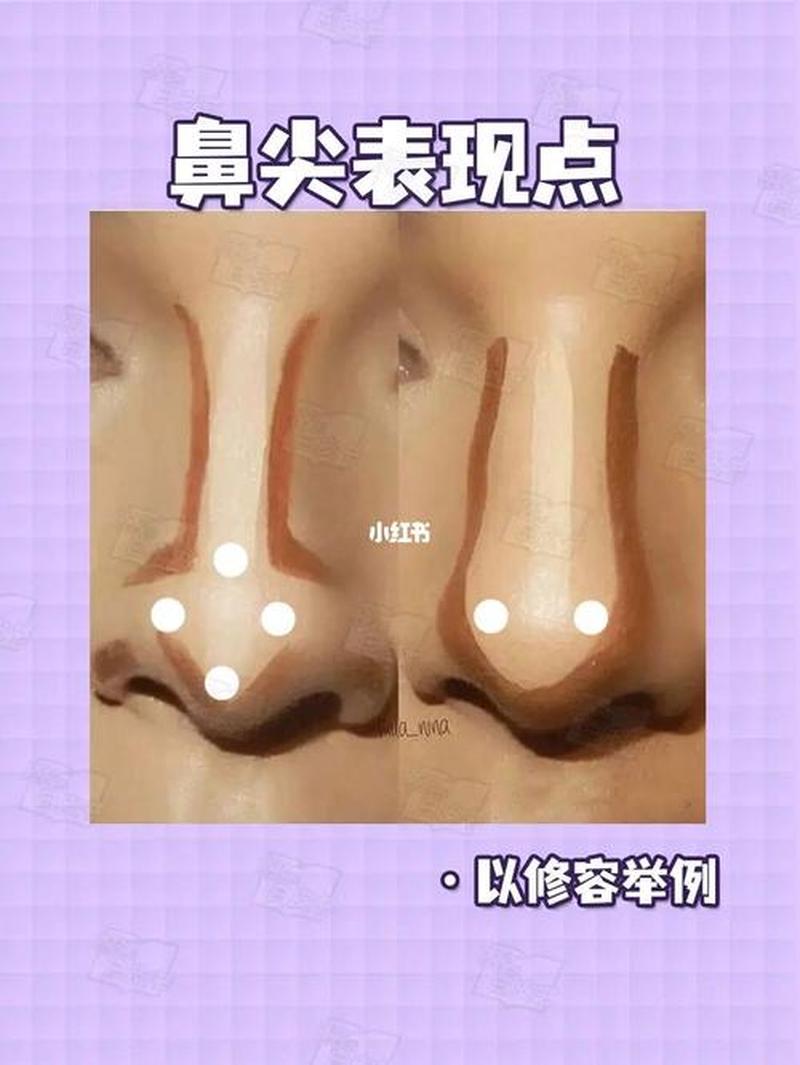 鼻尖软骨疼(鼻尖软骨疼痛一按就疼怎么办)-第1张图片-铖浩科技