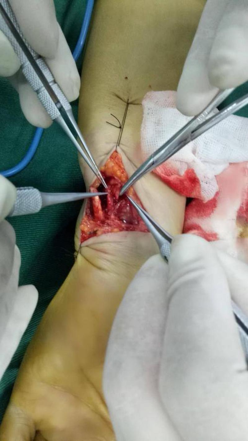 顺产手腕疼_顺产手腕筋骨疼怎么办-第1张图片-铖浩科技