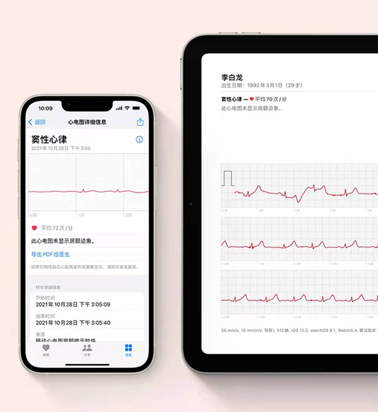 苹果Apple Watch 国行ECG心电图功能正式上线，能帮助用户识别房颤-第3张图片-科技快讯