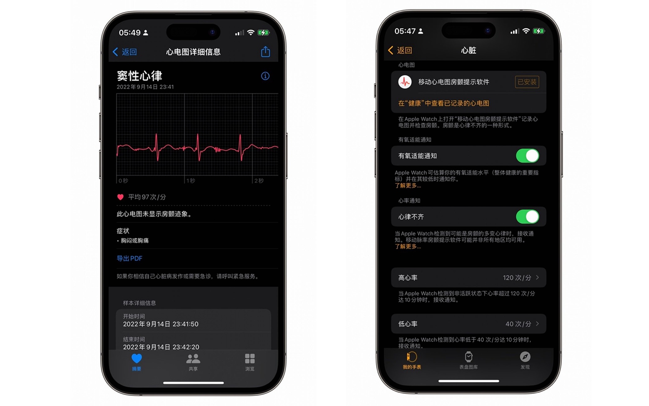 9月29日世界心脏日，苹果带来Apple Watch的心脏健康知识-第2张图片-科技快讯