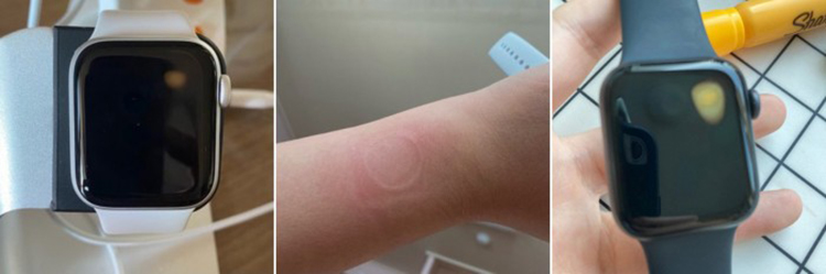 部分Apple Watch SE存在过热现象 新系统修复三代手表重启问题-第1张图片-科技快讯