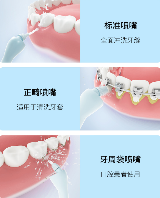 小米有品上架可视冲牙器 内置500万像素摄像头-第3张图片-科技快讯
