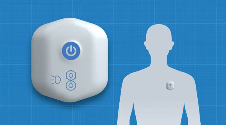 BioIntelliSense推出医疗用可穿戴设备 能检测20多种生命特征-第2张图片-科技快讯