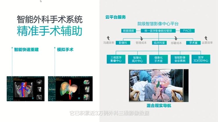 海信发布全球首款55英寸Mini-LED医用内窥显示器：采用超高清视频信号-第5张图片-科技快讯