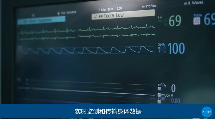 MWC2021 | 中兴发布"5G智慧T恤"，可实时监测汗液、肌肉以及体温等信息-第2张图片-科技快讯