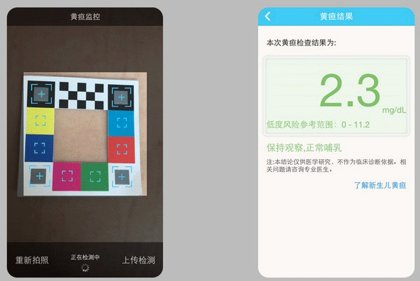 哪吒保贝测黄疸免费版使用方法3