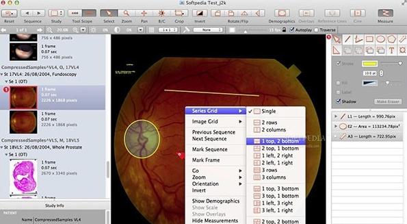 Escape Medical Viewer For Mac截图