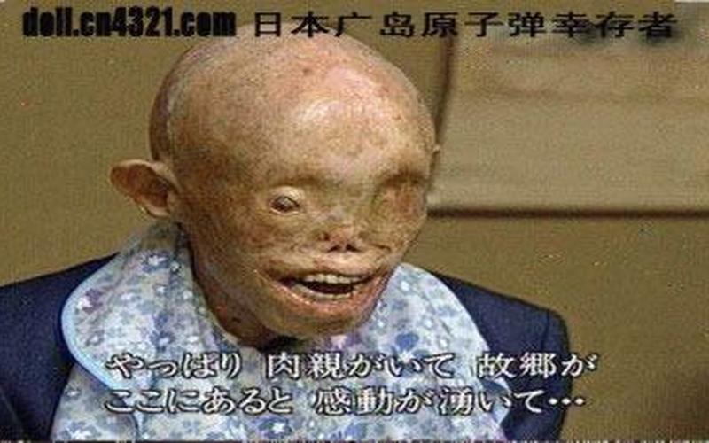 广岛长崎现状;广岛长崎现状后幸存生物